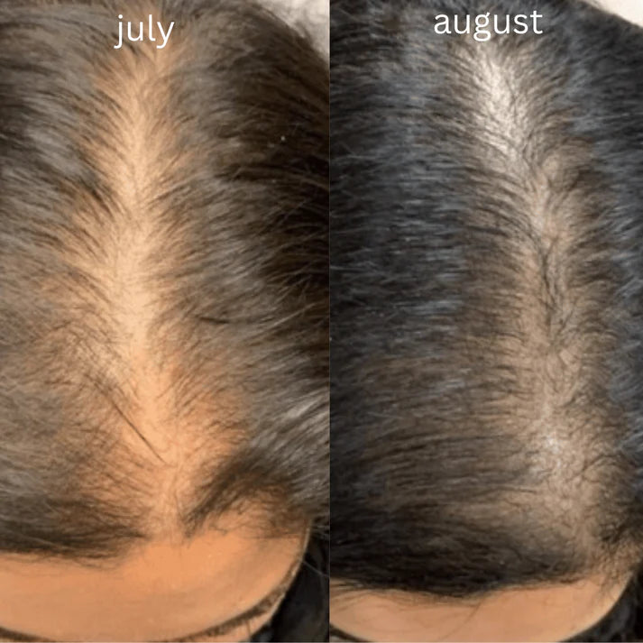 VR Hair Growth Oil for Reducing Hair Fall & Eliminating Dandruff